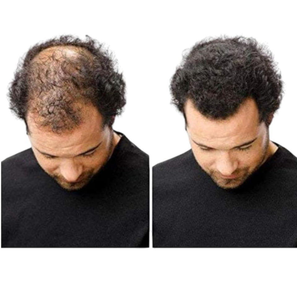 Hair Building Fiber for All Hair Types - Adds Volume & Thickness - 22g