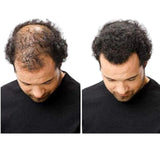 Hair Building Fiber for All Hair Types - Adds Volume & Thickness - 22g