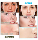 Turmeric Kojic Acid Exfoliating Cleansing Pads