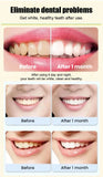 Sp-4 Probiotic Ultra Whitening Toothpaste