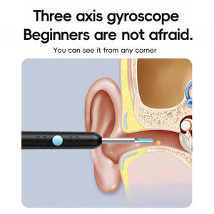 SmartScan Wireless Ear Cleaner with Camera