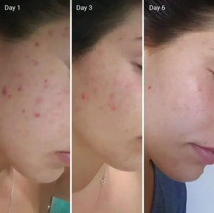NIGHT Cream Whitening Cream