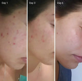 NIGHT Cream Whitening Cream