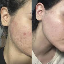 AXIS Y DARK SPOT CORRECTING GLOW SERUM