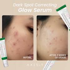 AXIS Y DARK SPOT CORRECTING GLOW SERUM