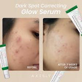 AXIS Y DARK SPOT CORRECTING GLOW SERUM